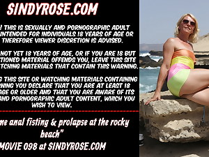 Extraordinary anal fisting &amp; prolapse at the rocky beach